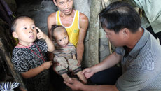 三姐弟的健康旅程，从瑞康医院开始——瑞康医院联合广西红十字会对“马蹄足三姐弟”进行救助