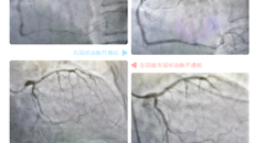 各大医院say no的病，国壮治了，还挺成功~