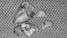 了解一下微创拔牙，别对口腔科存在“刻板印象”~
