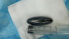 又一个误吞玩具的孩子，全靠医生“网”出来......