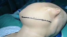 【附属国际壮医医院】硬气！“这台手术，我不做，广西就没人帮他做了！”