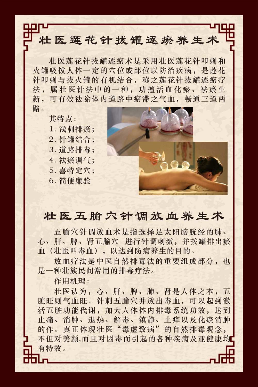 莲花针五腧穴针